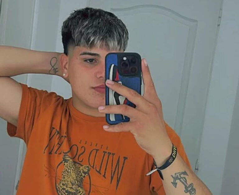 Thiago Medina mostró sus impactantes cicatrices tras el fuerte accidente sufrido en moto: «Para toda la vida»